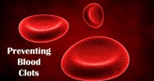 Preventing Blood Clots: A Lifesaving Guide. Picture of animated blood particles floating around.